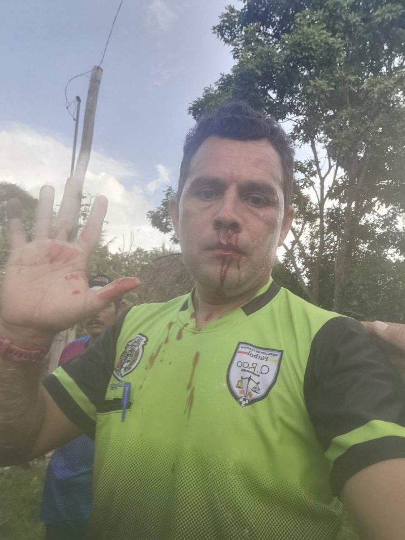 Jorge Cen del equipo Mayas FCP es denunciado por el árbitro Henry Angulo por golpearlo