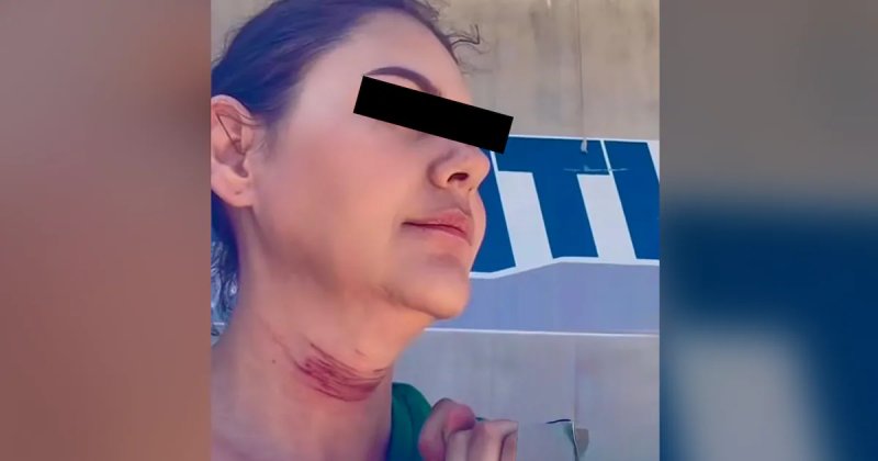 Mujer se quita la vida tras cirugía mal realizada en Tijuana