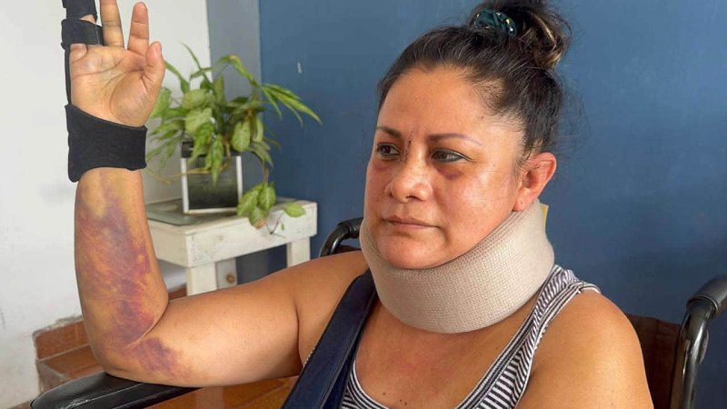 DOCTORA DENUNCIA PRESUNTO INTENTO DE FEMINICIDIO EN CHIAPAS; SEÑALA A DIRIGENTE POLÍTICO Chiapas.– La doctora Selene Mar...