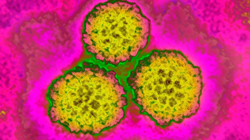 Millones de nuevos casos de cáncer en todo el mundo podrían ser causados por infecciones que pueden